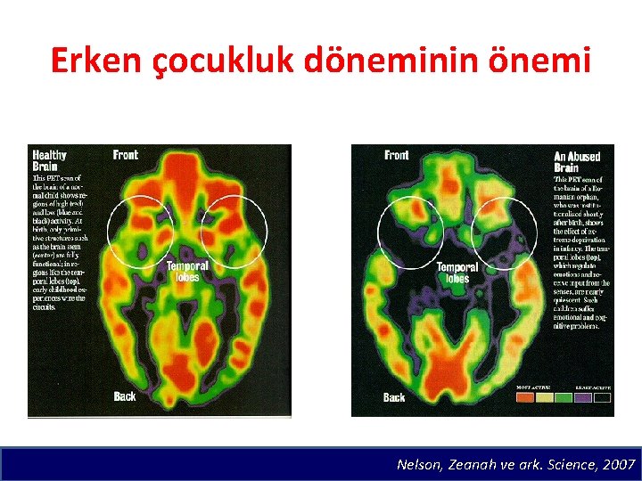 Erken çocukluk döneminin önemi Nelson, Zeanah ve ark. Science, 2007 