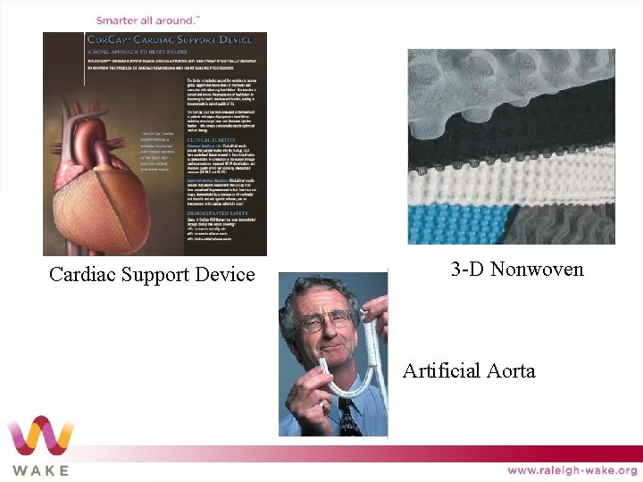 Cardiac Support Device 3 -D Nonwoven Artificial Aorta 