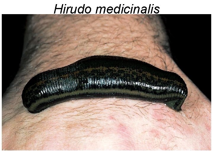 Hirudo medicinalis 