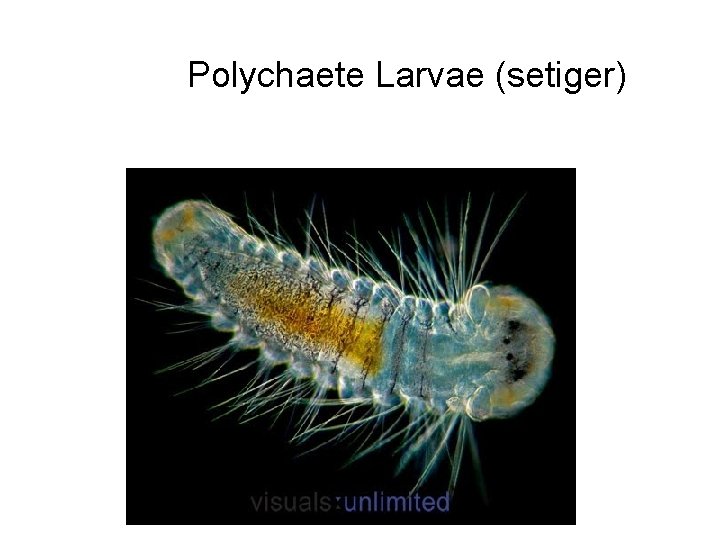 Polychaete Larvae (setiger) 