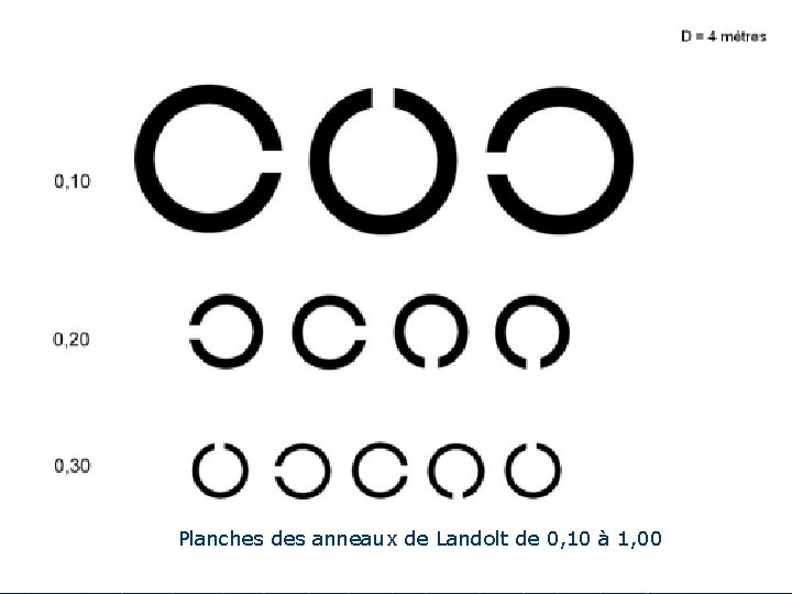 Planches des anneaux de Landolt de 0, 10 à 1, 00 