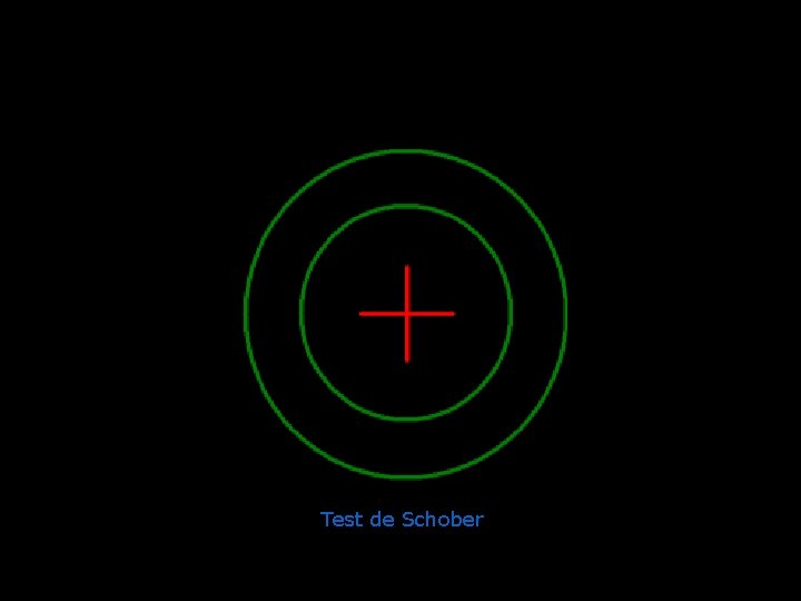 Test de Schober 