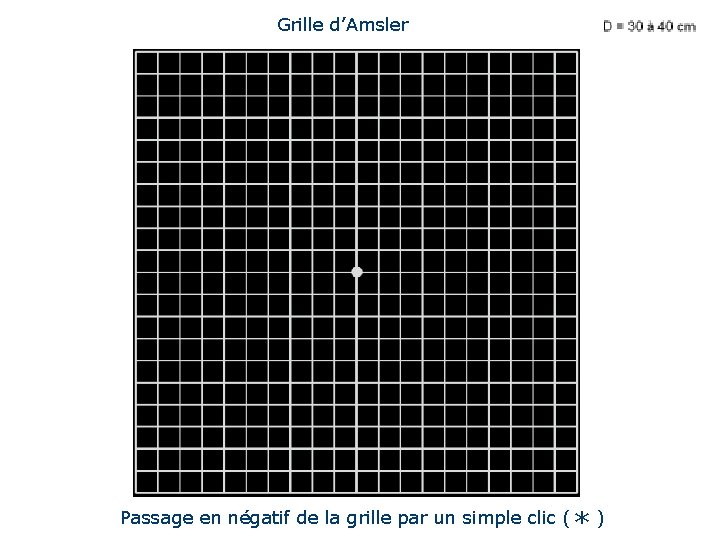 Grille d’Amsler Passage en négatif par simple clic Passage en négatif de la grille