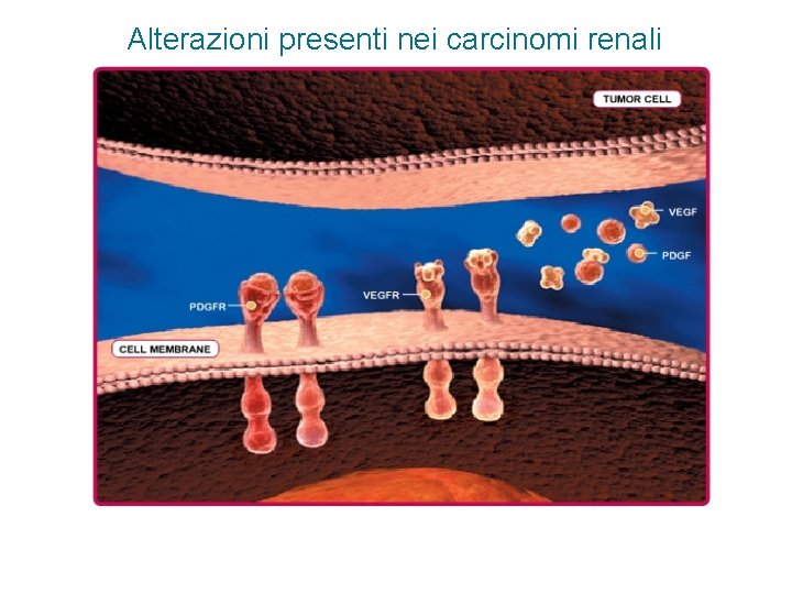 Alterazioni presenti nei carcinomi renali 1 MUTAZIONE DI VHL 2 STABILIZZAZIONE E ACCUMULO DI