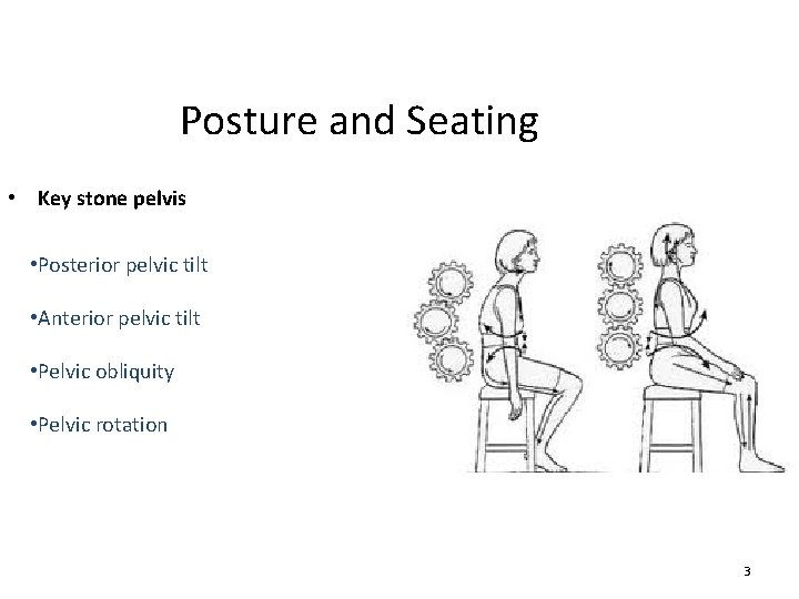 Posture and Seating • Key stone pelvis • Posterior pelvic tilt • Anterior pelvic Posture and Seating • Key stone pelvis • Posterior pelvic tilt • Anterior pelvic