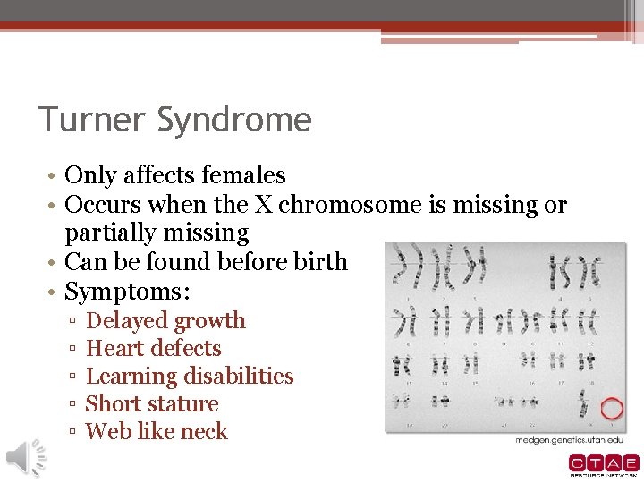 Turner Syndrome • Only affects females • Occurs when the X chromosome is missing Turner Syndrome • Only affects females • Occurs when the X chromosome is missing