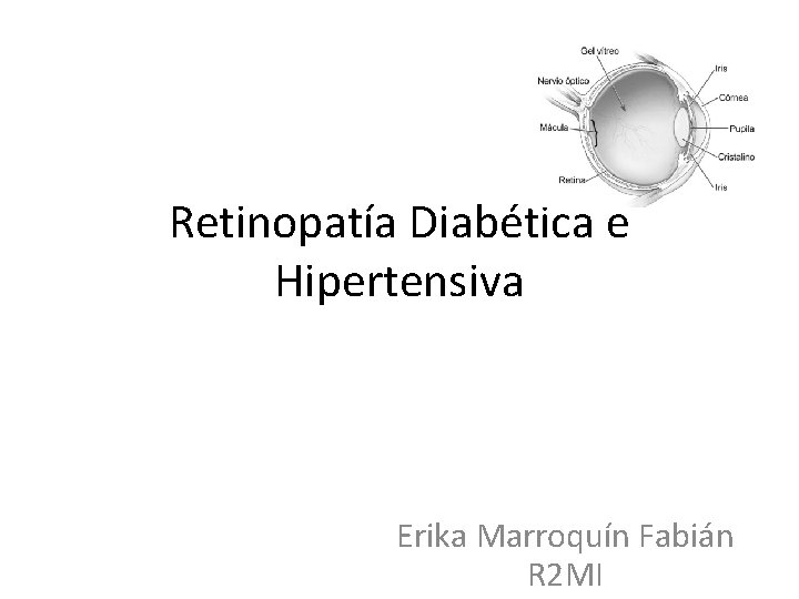 Retinopatía Diabética e Hipertensiva Erika Marroquín Fabián R 2 MI 