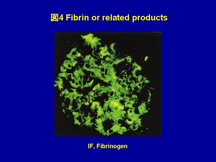 図 4 Fibrin or related products IF, Fibrinogen 