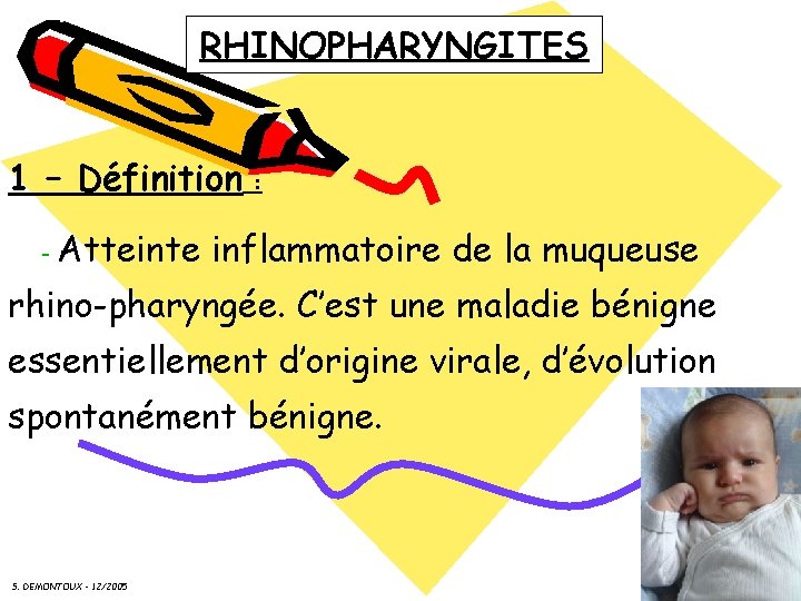 RHINOPHARYNGITES 1 – Définition : - Atteinte inflammatoire de la muqueuse rhino-pharyngée. C’est une