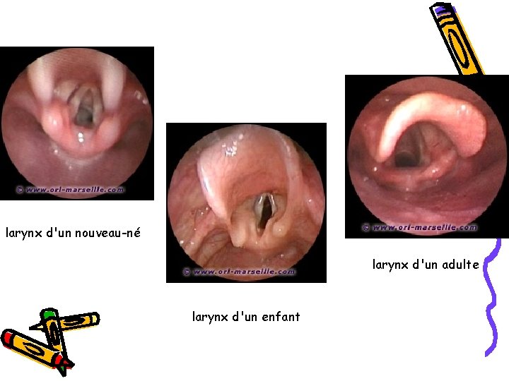 larynx d'un nouveau-né larynx d'un adulte larynx d'un enfant 