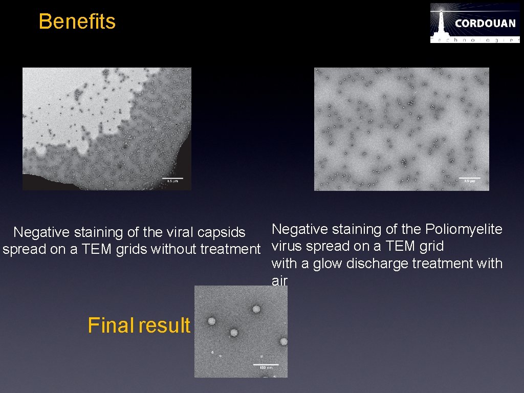 Benefits Negative staining of the Poliomyelite Negative staining of the viral capsids spread on