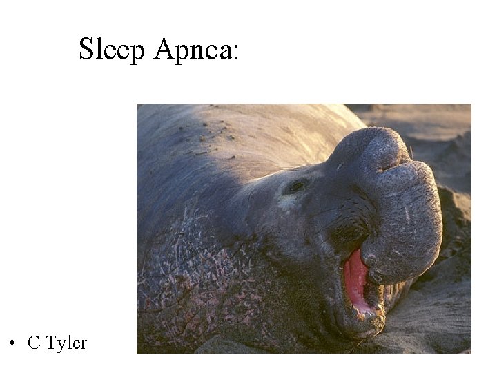 Sleep Apnea: • C Tyler 