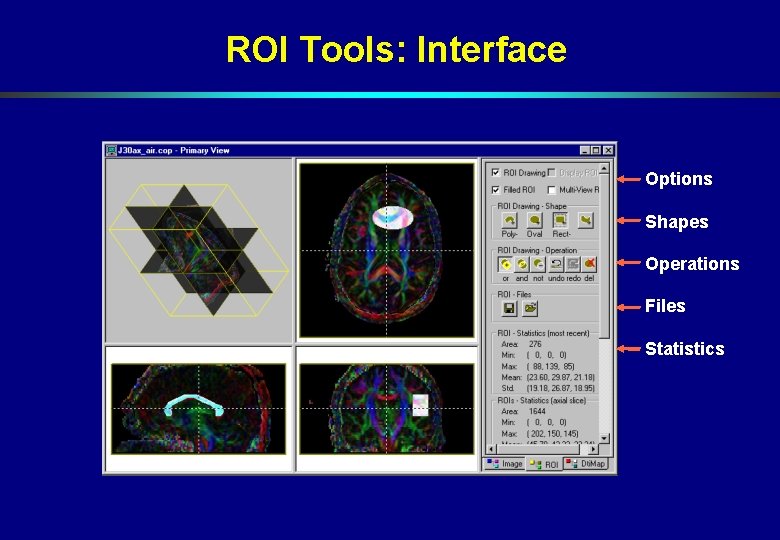 ROI Tools: Interface Options Shapes Operations Files Statistics ROI Tools: Interface Options Shapes Operations Files Statistics