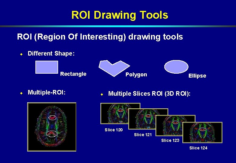 ROI Drawing Tools ROI (Region Of Interesting) drawing tools ¨ Different Shape: Rectangle ¨ ROI Drawing Tools ROI (Region Of Interesting) drawing tools ¨ Different Shape: Rectangle ¨