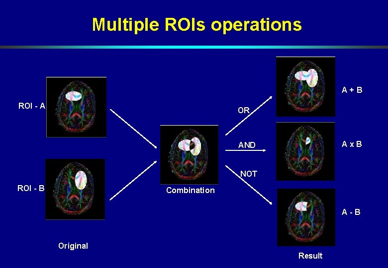 Multiple ROIs operations A+B ROI - A OR Ax. B AND NOT ROI - Multiple ROIs operations A+B ROI - A OR Ax. B AND NOT ROI -