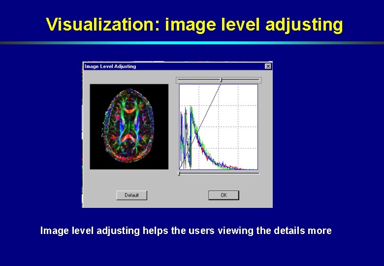 Visualization: image level adjusting Image level adjusting helps the users viewing the details more Visualization: image level adjusting Image level adjusting helps the users viewing the details more