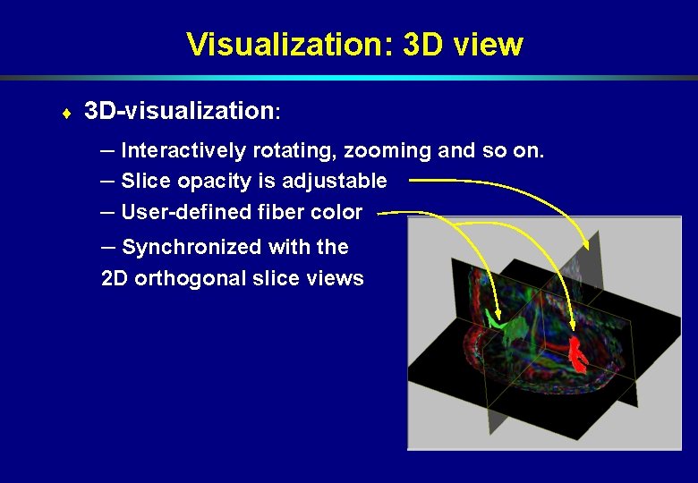 Visualization: 3 D view ¨ 3 D-visualization: – Interactively rotating, zooming and so on. Visualization: 3 D view ¨ 3 D-visualization: – Interactively rotating, zooming and so on.