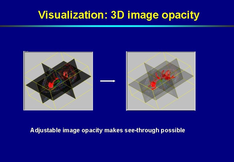 Visualization: 3 D image opacity Adjustable image opacity makes see-through possible Visualization: 3 D image opacity Adjustable image opacity makes see-through possible