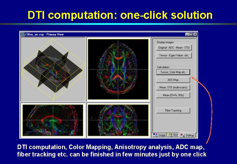 DTI computation: one-click solution DTI computation, Color Mapping, Anisotropy analysis, ADC map, fiber tracking DTI computation: one-click solution DTI computation, Color Mapping, Anisotropy analysis, ADC map, fiber tracking