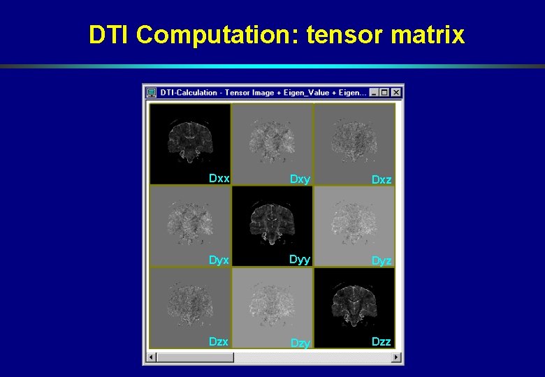 DTI Computation: tensor matrix Dxy Dxz Dyx Dyy Dyz Dzx Dzy Dzz DTI Computation: tensor matrix Dxy Dxz Dyx Dyy Dyz Dzx Dzy Dzz