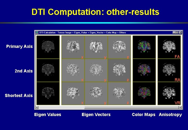 DTI Computation: other-results Primary Axis x y z FA x y z RA x DTI Computation: other-results Primary Axis x y z FA x y z RA x