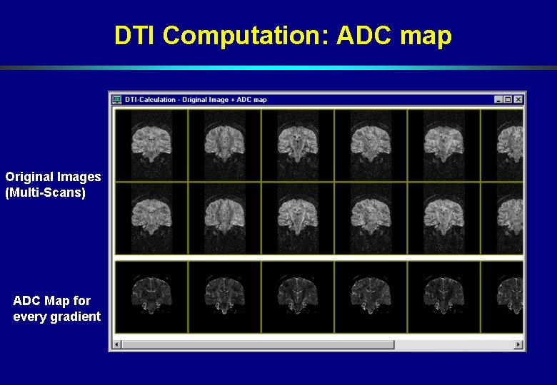 DTI Computation: ADC map Original Images (Multi-Scans) ADC Map for every gradient DTI Computation: ADC map Original Images (Multi-Scans) ADC Map for every gradient