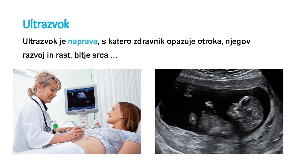 Ultrazvok je naprava, s katero zdravnik opazuje otroka, njegov razvoj in rast, bitje srca Ultrazvok je naprava, s katero zdravnik opazuje otroka, njegov razvoj in rast, bitje srca