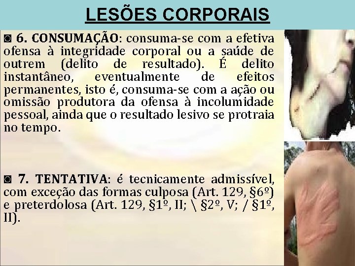 LESÕES CORPORAIS ◙ 6. CONSUMAÇÃO: consuma-se com a efetiva ofensa à integridade corporal ou