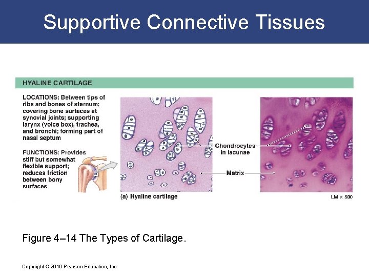 Supportive Connective Tissues Figure 4– 14 The Types of Cartilage. Copyright © 2010 Pearson