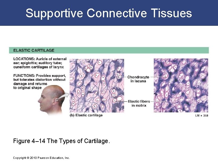 Supportive Connective Tissues Figure 4– 14 The Types of Cartilage. Copyright © 2010 Pearson
