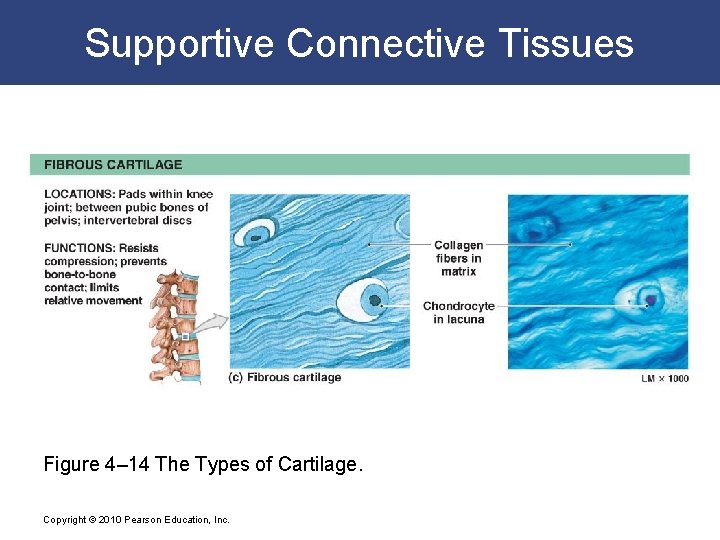 Supportive Connective Tissues Figure 4– 14 The Types of Cartilage. Copyright © 2010 Pearson