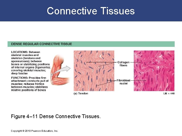 Connective Tissues Figure 4– 11 Dense Connective Tissues. Copyright © 2010 Pearson Education, Inc.
