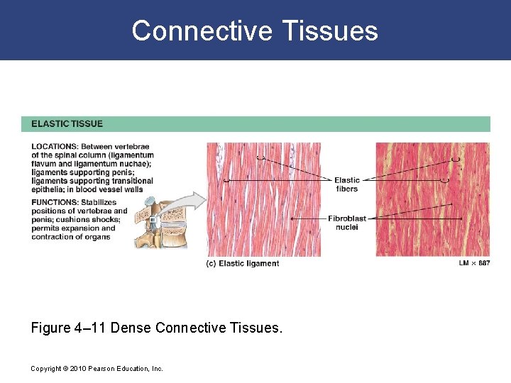 Connective Tissues Figure 4– 11 Dense Connective Tissues. Copyright © 2010 Pearson Education, Inc.