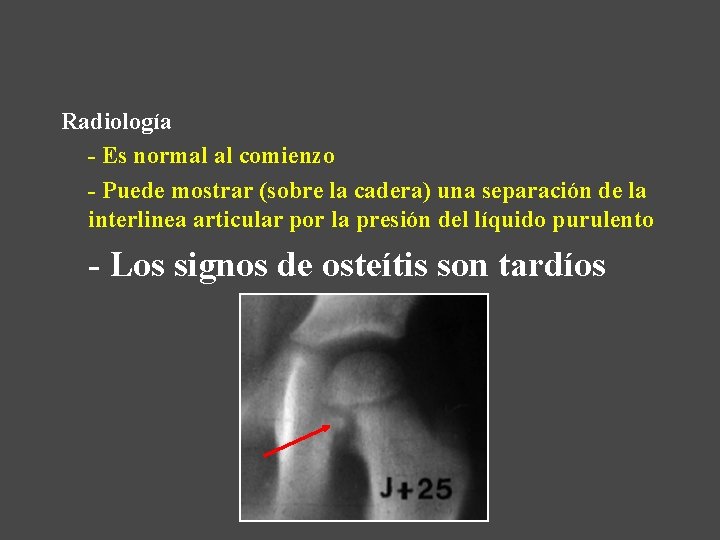 Radiología - Es normal al comienzo - Puede mostrar (sobre la cadera) una separación
