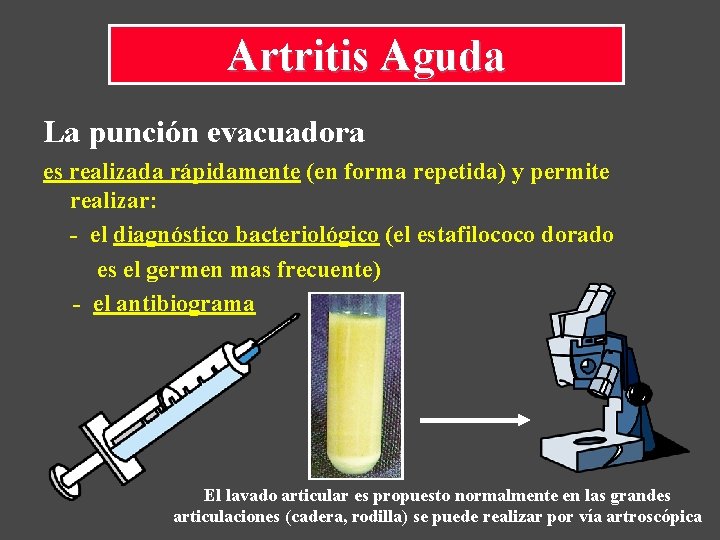 Artritis Aguda La punción evacuadora es realizada rápidamente (en forma repetida) y permite realizar: