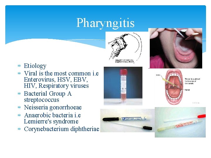 Pharyngitis Etiology Viral is the most common i. e Enterovirus, HSV, EBV, HIV, Respiratory