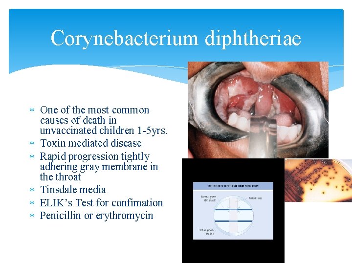 Corynebacterium diphtheriae One of the most common causes of death in unvaccinated children 1