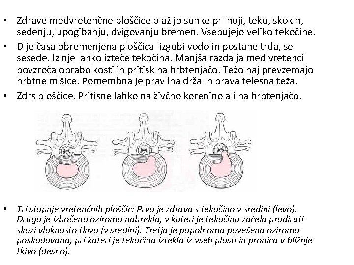  • Zdrave medvretenčne ploščice blažijo sunke pri hoji, teku, skokih, sedenju, upogibanju, dvigovanju