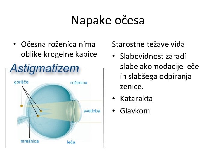 Napake očesa • Očesna roženica nima oblike krogelne kapice Starostne težave vida: • Slabovidnost