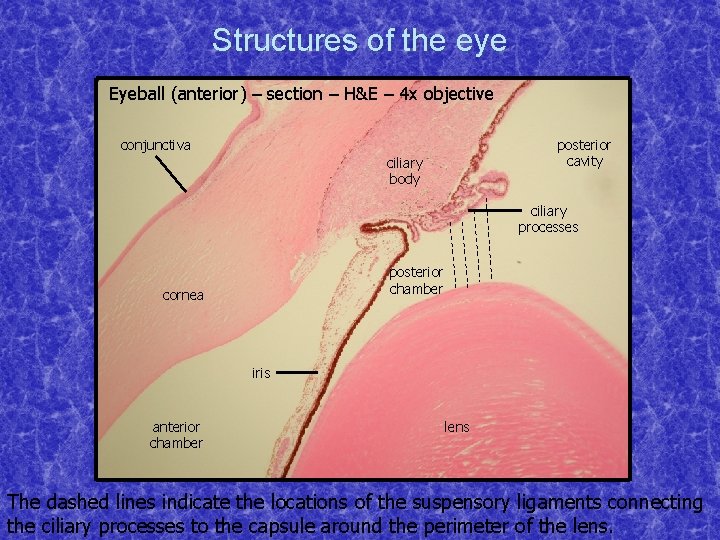 Structures of the eye Eyeball (anterior) – section – H&E – 4 x objective