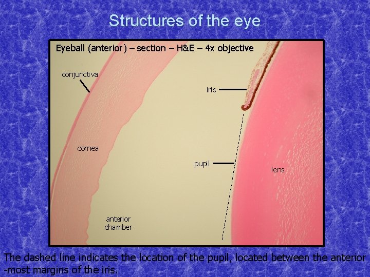 Structures of the eye Eyeball (anterior) – section – H&E – 4 x objective