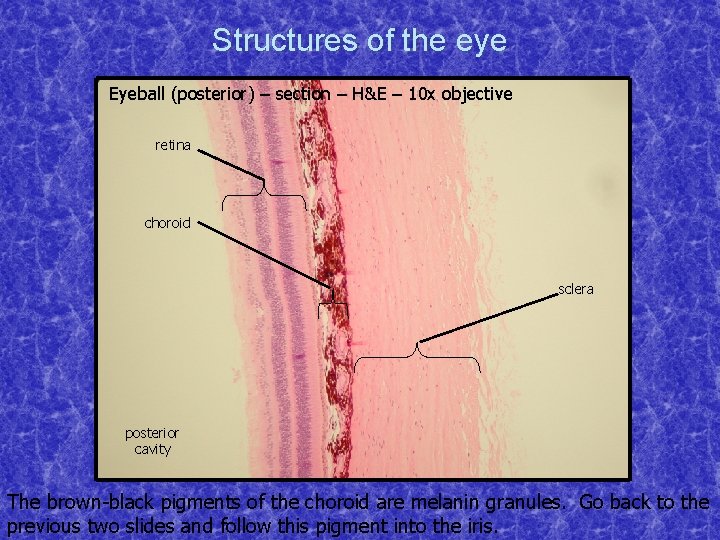 Structures of the eye Eyeball (posterior) – section – H&E – 10 x objective