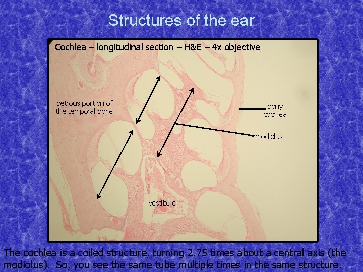 Structures of the ear Cochlea – longitudinal section – H&E – 4 x objective