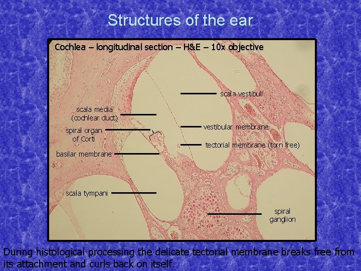 Structures of the ear Cochlea – longitudinal section – H&E – 10 x objective