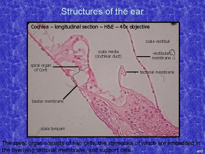 Structures of the ear Cochlea – longitudinal section – H&E – 40 x objective
