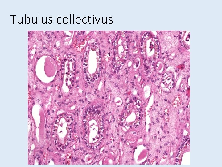 Tubulus collectivus 