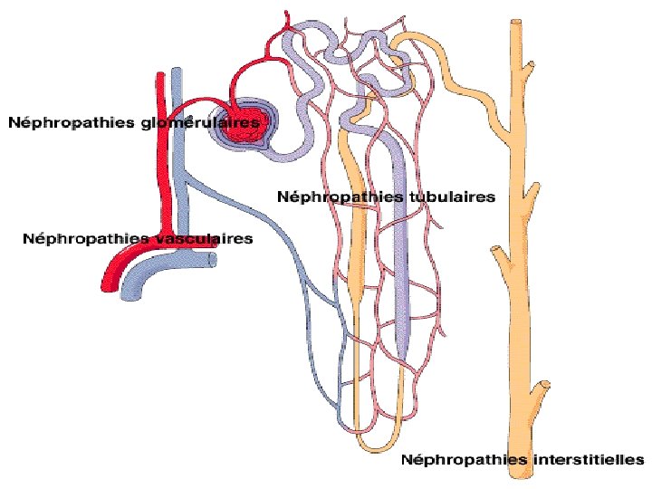 Classifications des néphropathies 