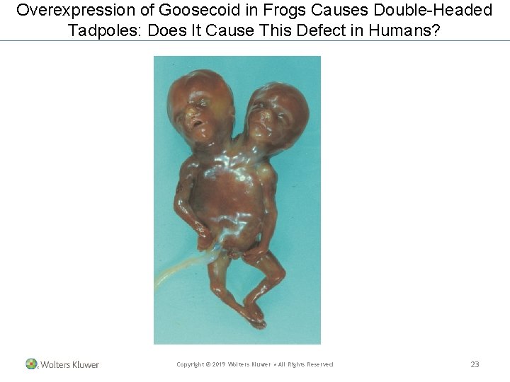 Overexpression of Goosecoid in Frogs Causes Double-Headed Tadpoles: Does It Cause This Defect in Overexpression of Goosecoid in Frogs Causes Double-Headed Tadpoles: Does It Cause This Defect in