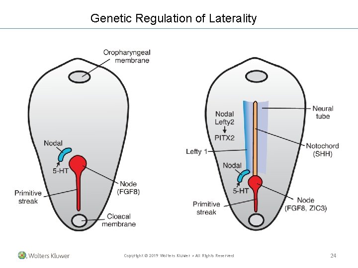 Genetic Regulation of Laterality Copyright © 2019 Wolters Kluwer • All Rights Reserved 24 Genetic Regulation of Laterality Copyright © 2019 Wolters Kluwer • All Rights Reserved 24