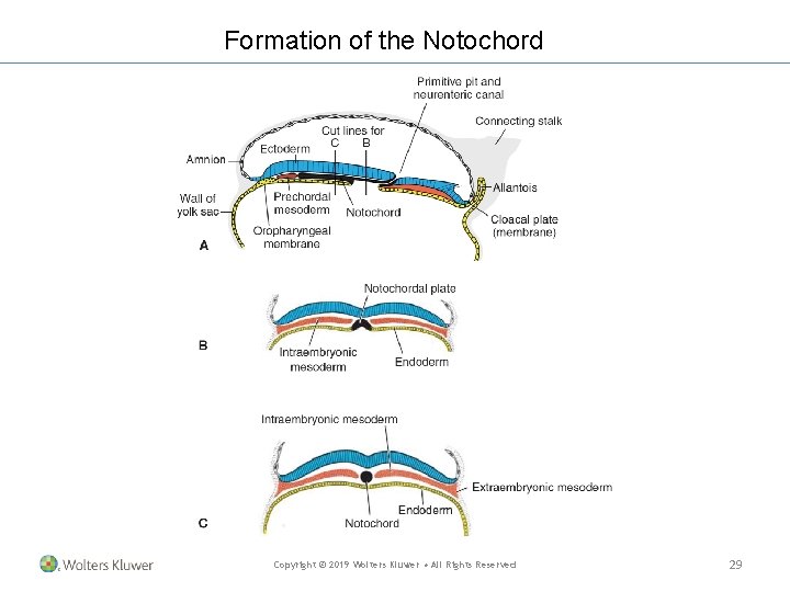 Formation of the Notochord Copyright © 2019 Wolters Kluwer • All Rights Reserved 29 Formation of the Notochord Copyright © 2019 Wolters Kluwer • All Rights Reserved 29